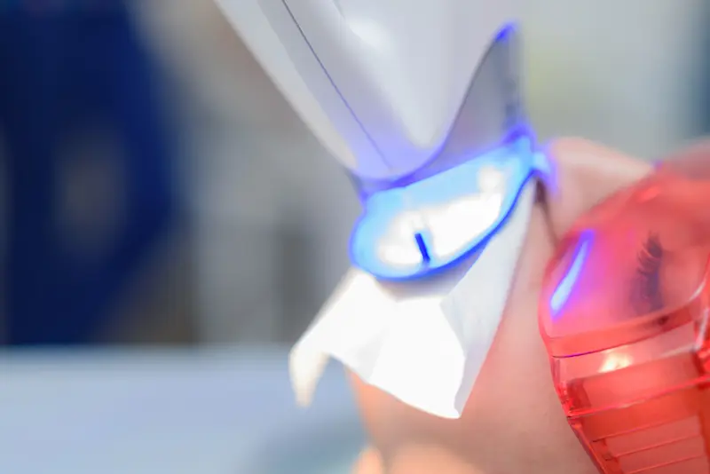 trattamento sbiancamento denti  LED a livorno